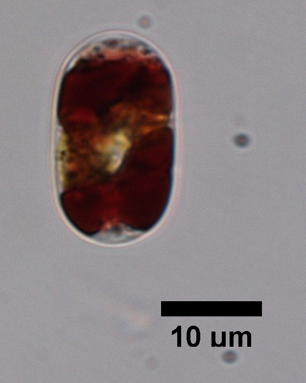 A deep purple alga from the Greenland ice sheet. Photo: Laura Halbach, AU. A microscope photo of a purple alga.
